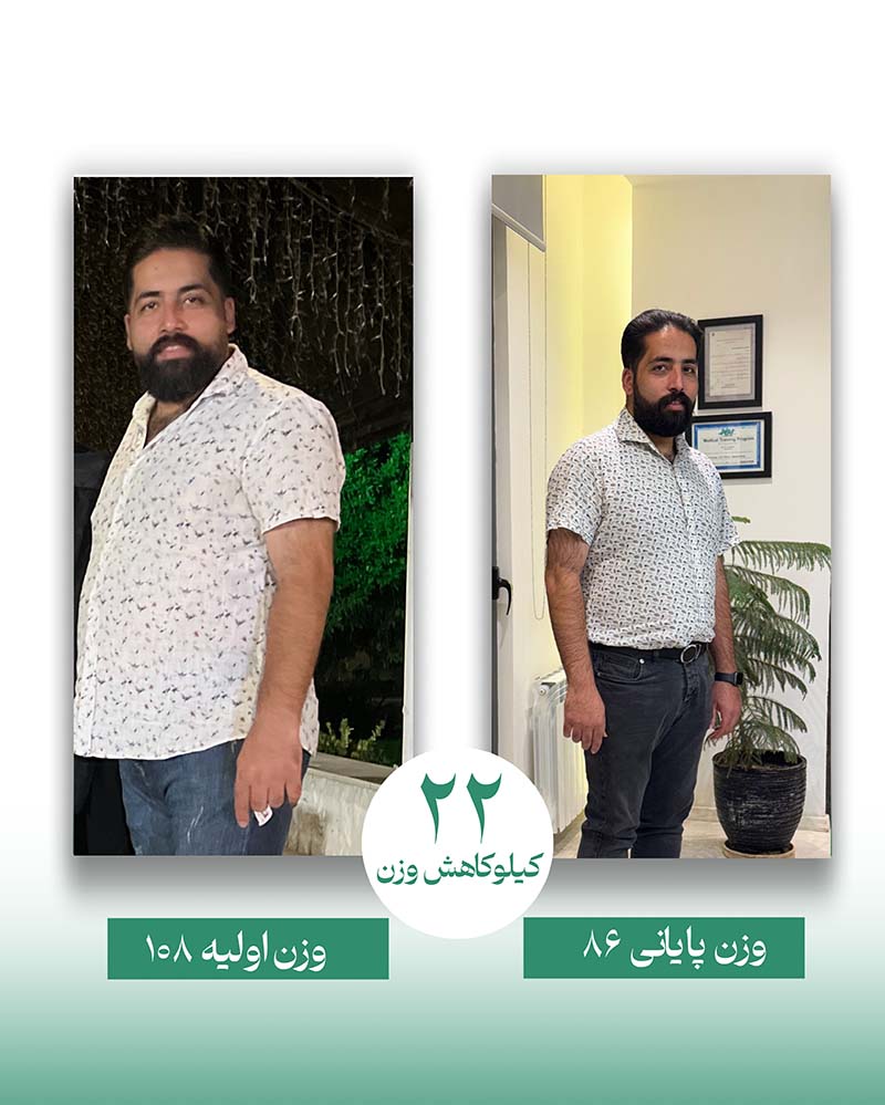 22کیلو کاهش وزن با ایمپلنت مدانچ
